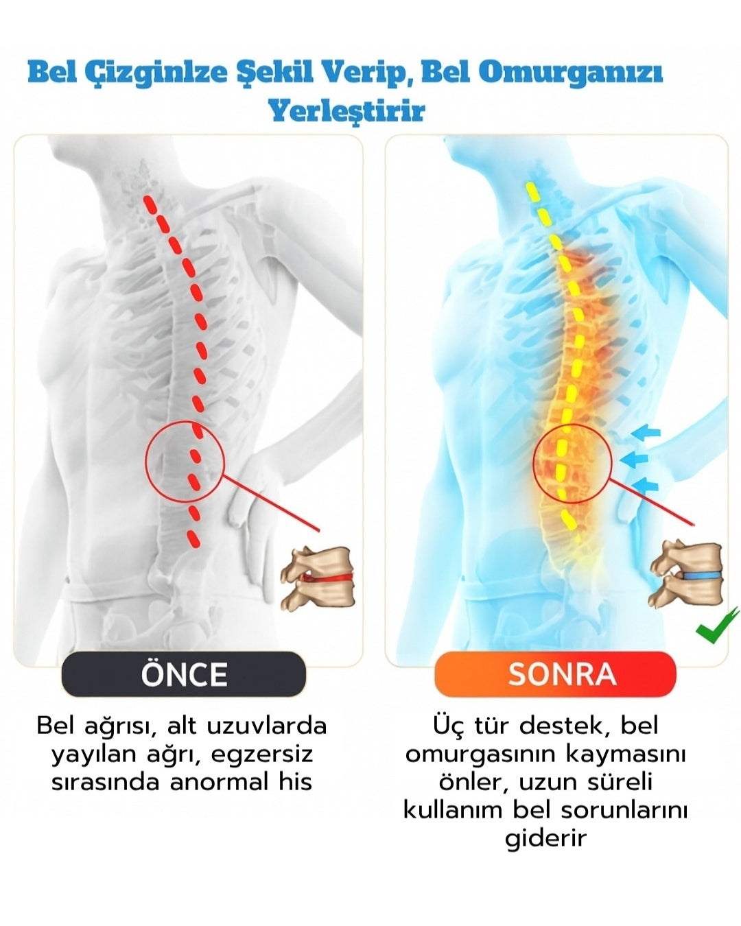 ThermoRelief Ortopedik Bel Desteği